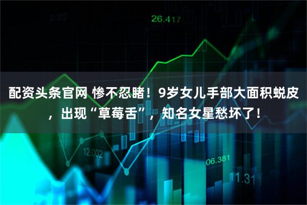 配资头条官网 惨不忍睹！9岁女儿手部大面积蜕皮，出现“草莓舌”，知名女星愁坏了！